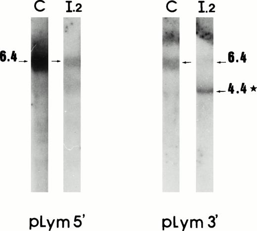 Fig. 3. mRNA deletion in lymphoblastoid cells. Northern blot analysis using cDNA probes pLym5′ and pLym3′. The band sizes are given in kilobases. *Additional band present in the proposita. C, control; I.2, proposita.