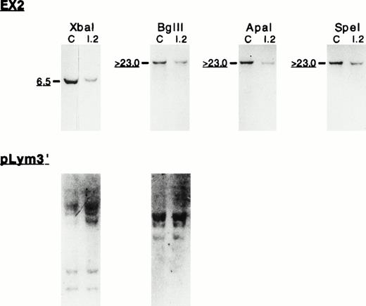 Fig. 5. Southern blot analysis of the 5′ endpoint genomic deletion. (Top) Southern blot analysis of genomic DNA from control (C) and proposita (I.2), using EX2 cDNA probe (see also Fig 1). Notice the reduced signal intensity (underlined sizes bands) consistently found in the patient with EX2 probe. Restriction enzymes used are indicated. Band sizes (in kilobases) are given. (Bottom) Hybridization of the sameXba I/Bgl II membrane with pLym3′ probe that covers the nondeleted region of 4.1 Annecy gene.