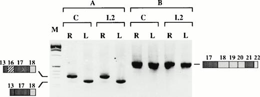 Fig. 7. Tissue-specific splicing of exons downstream from the deletion. (Top) Schematic representation of the PCR strategy; the expected PCR products and their sizes in basepairs are shown. (Bottom) RT-PCR on reticulocyte (R) or lymphoblastoid cell (L) mRNA, using primers XIII/XIV (A) or primers XV/XVI (B). C, control; I.2, proposita; M, size marker.