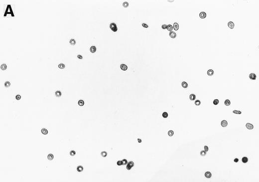 Fig. 1. Generation of ISCs after in vitro cycling. (A) Shows light density RBCs before in vitro cycling. (B) Shows SS erythrocytes after 16 hours of in vitro cycling in the absence of NAC. (C) Shows SS erythrocytes cycled in the presence of 20 mmol/L NAC with a reduction in the formation of ISCs.