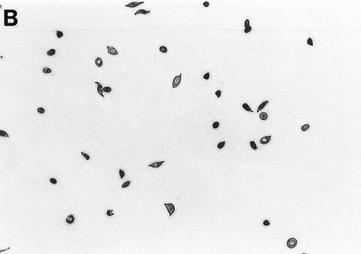 Fig. 1. Generation of ISCs after in vitro cycling. (A) Shows light density RBCs before in vitro cycling. (B) Shows SS erythrocytes after 16 hours of in vitro cycling in the absence of NAC. (C) Shows SS erythrocytes cycled in the presence of 20 mmol/L NAC with a reduction in the formation of ISCs.