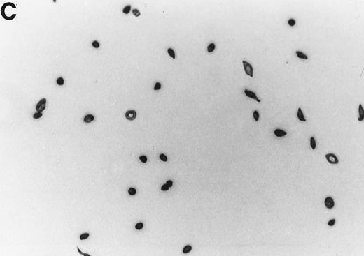 Fig. 1. Generation of ISCs after in vitro cycling. (A) Shows light density RBCs before in vitro cycling. (B) Shows SS erythrocytes after 16 hours of in vitro cycling in the absence of NAC. (C) Shows SS erythrocytes cycled in the presence of 20 mmol/L NAC with a reduction in the formation of ISCs.