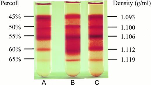 Fig. 2. Effect of NAC on SS erythrocyte density. Low density SS erythrocytes that were incubated at 37°C for 16 hours without cycling or NAC (A), with cycling, but without NAC (B), and with cycling in the presence of 20 mmol/L NAC (C), were placed on Percoll gradients (45% to 65%) and centrifuged at 907g for 45 minutes. Note NAC's ability to inhibit dense cell formation. Density of the RBCs in different Percoll layers was obtained by sedimenting density marker beads (Pharmacia, Piscataway, NJ) under identical conditions.