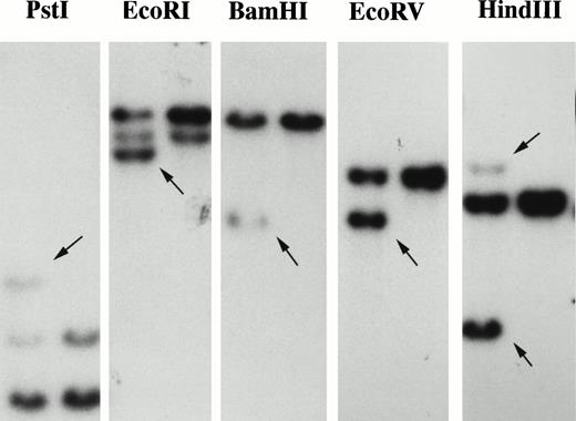 Fig. 1. Identification and molecular analysis of t(5;7)(q33;q11.2). Southern blot analysis of thePDGFβR gene locus in patient DNA with t(5;7)(q33;q11.2). Genomic DNA of patient t(5;7)-positive cells (lane 1) and control cells (lane 2) was analyzed by Southern blotting with a 1.1-kb HindIII-Xho I PDGFβRprobe.6 Arrows indicate the rearranged bands in theEcoRI, BamHI, Pst I, EcoRV, andHindIII digests.