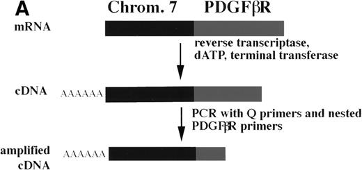 Fig. 2. Identification of the chromosome 7 fusion partner. (A) Schematic diagram of anchored PCR.619 (B) Sequence of theHIP1/PDGFβR breakpoint and schematic of the fusion protein. (C) Southern blot analysis of HIP1 gene locus in control DNA (lanes 1 and 2) and patient DNA (lane 3). Arrows indicate rearranged fragments in the Pst I and Xba I digests.