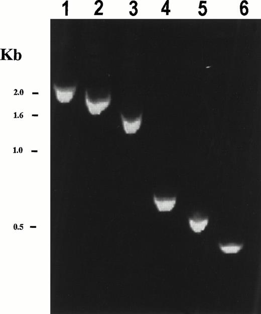 Fig. 3. Expression of the chimericHIP1/PDGFβR mRNA in patient bone marrow. RT-PCR analysis of HIP1/PDGFβR was performed using total RNA (2 μg) from t(5;7) patient bone marrow that had been reverse transcribed using the Qt primer. PCR was performed using a HIP301F forward primer and the PDGFβR 1848R primer for 30 cycles (94°C for 1 minute, 60°C for 2 minutes, and 72°C for 3 minutes). Nested PCR was performed on PCR products from the first reaction diluted 20-fold and amplified using the same PCR reaction conditions with HIP1 forward primers HIP721F, HIP1141F, HIP1561F, HIP2372F, HIP2494F, and HIP2613F in lanes 1 through 6, respectively, and the PDGFβR reverse primer 1806R. HIP1 primer numbers correspond to the first nucleotide of a 20-bp primer of HIP1 sequence according to Kalchman et al.20 The expected band sizes are 2,279, 1,859, 1,439, 628, 506, and 387 bp for lanes 1 through 6, respectively. Control experiments with no template or in the absence of reverse transcriptase gave no PCR product (not shown). TheHIP1/PDGFβR fusion was not detected in normal bone marrow and neither was the reciprocalPDGFβR/HIP1 fusion transcript detected in t(5;7) patient bone marrow using a nested PCR reaction with primers PDGFβR1691F, PDGFβR1711F, HIP13071R, and HIP12966R (primer numbers correspond to the first nucleotide of a 20-bp primer of either PDGFβR22 orHIP120 sequence).