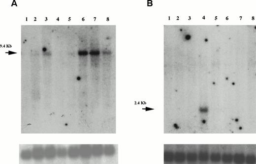 Fig. 4. Northern blot analysis of HIP1 mRNA in various tissues. Blots (Clontech) were probed with with an32P–end-labeled probe from HIP1 nucleotides 2890 to 2930.20 Exposure time was 12 hours. The lower panels are the same blots stripped and reprobed with actin cDNA. (A) Cell lines. RNA sources were HL60, HELA, K562, MOLT4, Raji, SW480, A549, and G361, designated 1 through 8, respectively. (B) Adult tissue RNA sources are spleen, thymus, prostate, testis, ovary, small intestine, colonic mucosa, and peripheral blood, designated 1 through 8, respectively.