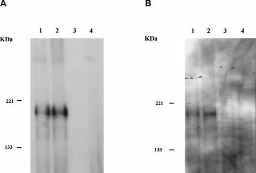 Fig. 5. HIP1/PDGFβR transforms Ba/F3 cells to factor independence. Two independent infections of Ba/F3 cells were performed. To assess protein expression and phosphorylation, lysates were immunoprecipitated with anti-PDGFβR antibody (tail; Pharmingen), separated on 8% polyacrylamide gel electrophoresis (PAGE), and blotted onto nitrocellulose. Proteins were detected with anti-PDGFβR peptide antibody directed against the C-terminus (part a) and HRP-conjugated anti-phosphotyrosine 4G10 monoclonal antibody (part b). Lanes 1 and 2 are the HIP1/PDGFβR stable infectants, and lanes 3 and 4 are neomycin-resistant controls. (C) The G418-resistant cells growing in IL-3 were seeded in 96-well trays with 2 × 104 cells per 200 μL per well in RPMI 1640 and 10% fetal calf serum media with or without IL-3. Cells were assessed for number and viability (trypan blue) in triplicate at 24-hour intervals. Each point is the average of the triplicate samples, with standard deviations ranging from 1% to 3% of the number of cells counted each day.
