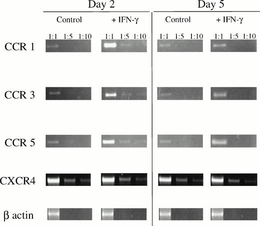 Fig. 3. IFN-γ enhances CR mRNA levels in U937 cells as determined by standardized RT-PCR. Samples containing similar a amount of viable cells as determined by trypan blue exclusion were analyzed at days 2 and 5 after treatment with IFN-γ. To determine the increase in mRNA expression upon treatment, samples were amplified using different dilutions (as indicated) and β-globin amplification was used to confirm comparability of the samples. The influence of possible contamination by genomic DNA in RT-PCR reactions was excluded by control amplifications in the absence of RT, because no signals were obtained under these conditions (not shown). Results are representative of 3 independent experiments.