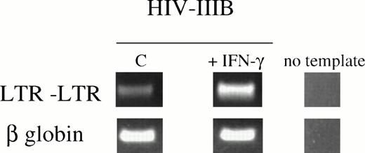 Fig. 5. IFN-γ increases susceptibility to HIV-1IIIB infection in U937 cells. Standardized PCR amplification of LTR(U3)-(U5)LTR circular forms of HIV-1 DNA was applied to assess de novo viral replication,23 20 hours after exposure. Samples were normalized by enumerating viable cells using trypan blue exclusion. β-Globin amplification was applied to confirm comparability of the samples. Results are representative of 4 independent experiments.