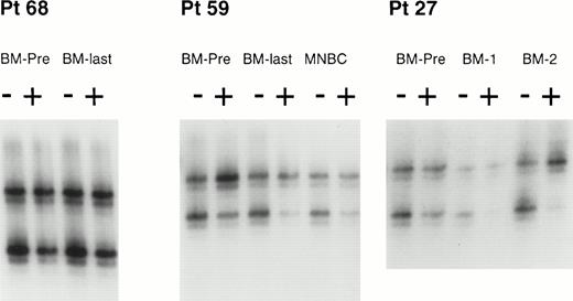 Fig. 2. Clonal analysis by the HUMARA assay of BM and MNBCs from 3 patients. HUMARA alleles were amplified by PCR in the absence (−) or in the presence (+) of Hpa II. The ratio of digested DNA/undigested DNA allows to correct for the potential preferential amplification of one allele over the other that occurs frequently. Shadow bands result from slippage of DNA polymerase during PCR amplification. In patient no. 68, both the pre-ABMT BM sample (BM-PRE) and the last available BM (BM-LAST) showed balanced methylation patterns, consistent with polyclonal hematopoiesis before and after ABMT. In patient no. 59, the pre-ABMT BM sample, the last available BM sample, and the MNBC control sample showed an inbalanced methylation pattern, with the predominance of the upper allele, consistent with a skewed XIP. In patient no. 27, the pre-ABMT BM sample showed a balanced methylation pattern (polyclonal hematopoiesis), but subsequent BM samples obtained after ABMT (BM-1 and BM-2) showed a progressive predominance of the upper allele. Thess results are consistent with the development of clonal hematopoiesis after ABMT. See text for definitions of skewed XIP, polyclonal hematopoeisis, and clonal hematopoiesis.