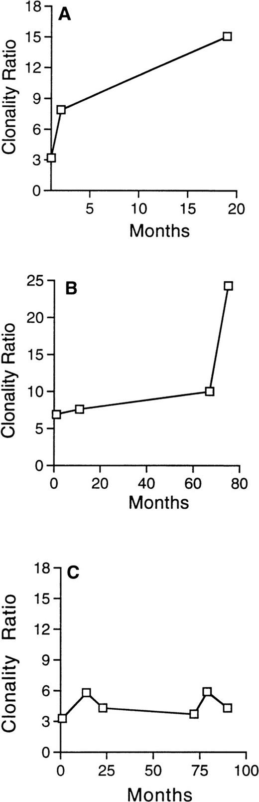 Fig. 3. Evolution of the clonality ratio in 3 patients with skewed XIP before ABMT, who subsequently developed t-MDS/AML. The progressive and significant increase of the clonality ratio, detected in serial analysis in patient no. 29 (A) and in patient no. 23 (B), attest to the clonal evolution. In contrast, no significant change is detected in the clonality ratio of patient no. 2 (C), despite development of t-MDS/AML 36 months after ABMT.