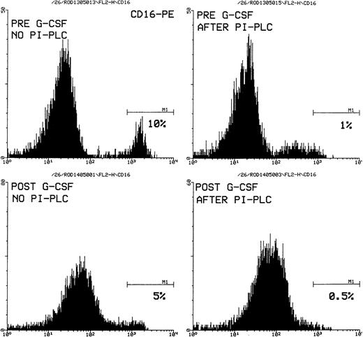 Fig. 2. FACScan histogram plots showing peripheral blood neutrophils from patient no. PNH046 stained with anti–CD16-PE (phycoerythrin). The upper two plots are before G-CSF treatment and show a large PNH population (CD16−ve) and a small, normal, CD16+ve population. The CD16 is cleaved off by PI-PLC in the upper right plot but this enzyme has no effect on the negative peak. In the lower two plots, after G-CSF treatment, the negative peak has shifted to the right but this apparent increase in CD16 expression is not affected by PI-PLC (see text).