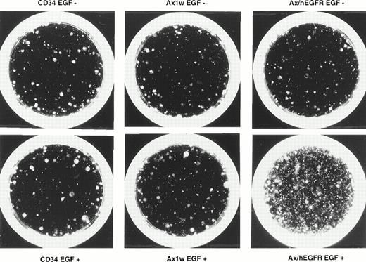 Fig. 4. Photomicrograph of the effect of EGF through adenovirus-mediated EGFR on the expansion of colony-forming cells after 5 days of suspension culture. Purified CD34+ PB cells were expanded as described in the Materials and Methods in the presence or absence of EGF and plated in methylcellulose colony assay. This figure shows the representative results of day-28 colonies of the expanded cells from 2,000 CD34+ cells in each fraction. In the figure, CD34 denotes the results of the uninfected control fractions.