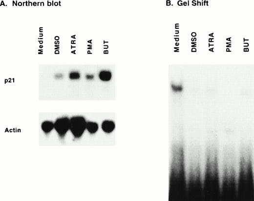 Fig. 4. Protein-binding of a p21 promoter fragment is inversely associated with p21 message expression. Log-phase HL-60 cells were exposed to medium alone or medium containing DMSO (1.25%), ATRA (1 μmol/L), PMA (80 nmol/L), or butyrate (1 mmol/L) and harvested 20 hours later for RNA and protein extraction. Northern blot (A) confirms p21 induction. Gel-shift assay (B) of 20 μg whole cell extract incubated with 44-bp promoter fragment discloses a band upon addition of uninduced extract, which is decreased in lanes using differentiating cell extract.