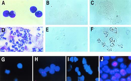 Fig. 2. p21 message and protein in CD34+ blast cells and in differentiated cells. (Top) In situ analysis of p21 message in CD34+ blast cells (above) and in neutrophils (below). (A) and (D), Wright Giemsa; (B) and (E), digoxigenin-labeled control; (C) through (F), digoxigenin-labeled p21 probe. (Bottom) Immunohistochemical demonstration of p21 protein in differentiating cells. Day 0 CD34+ blasts stained with isotype control (G) or anti-p21 antibodies. Some nonspecific staining of antibody-coated magnetic beads is present. Differentiated progeny arising after 11 days of culture stained with isotype control (I) or anti-p21 antibody (J) stain strongly for p21.