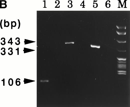 Fig. 4. (A) MLL and AF9 break points in UG3 cells. Break points in UG3 cells as determined by sequencing the RT-PCR products are shown with vertical black arrow heads. Primers are shown as horizontal arrow heads; ex, exon; bps, base pairs. (B) RT-PCR analysis for AF9-MLL and MLL-AF9 fusion transcripts in UG3 cells. RT-PCR analysis was performed as detailed in the Materials and Methods. Amplification reactions performed with all primer combinations failed to produce any PCR product, with the exception of the following primer pairs: AF9s-MLLex12as (lane 1), AF9s-MLLex14as (lane 3), and MLLex9s-AF9as (lane 5). As a control, RT-PCR analysis was also performed with reversely transcribed RNA obtained from K562 cells using these primer pairs, and reaction products were loaded into lanes 2, 4, and 6, respectively. Lane M depicts pBR322 DNA digested with Msp I as a molecular weight marker. Shown is one representative result of four independent experiments.