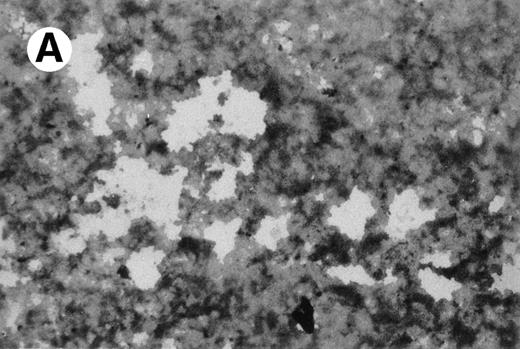 Fig. 11. Resorption of hydroxyapatite by osteoclast-like giant cells exposed to M-CSF and IL-4. Hydroxyapatite was stained black by Von Kossa staining. UG3 cells that had been cultured in the presence of M-CSF (100 ng/mL) and IL-4 (100 U/mL) had pericellular clear areas (A) resulting from hydroxyapatite resorption, whereas those that had been cultured in the presence of IL-3 (5 ng/mL) and IL-4 (100 U/mL) did not (B). Original magnification, 30-fold. Histochemical analysis was performed with cells obtained from three independent cultures.