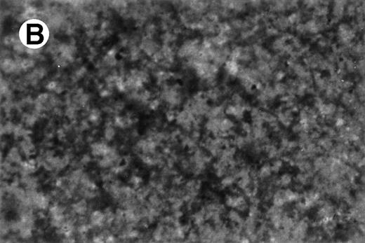 Fig. 11. Resorption of hydroxyapatite by osteoclast-like giant cells exposed to M-CSF and IL-4. Hydroxyapatite was stained black by Von Kossa staining. UG3 cells that had been cultured in the presence of M-CSF (100 ng/mL) and IL-4 (100 U/mL) had pericellular clear areas (A) resulting from hydroxyapatite resorption, whereas those that had been cultured in the presence of IL-3 (5 ng/mL) and IL-4 (100 U/mL) did not (B). Original magnification, 30-fold. Histochemical analysis was performed with cells obtained from three independent cultures.