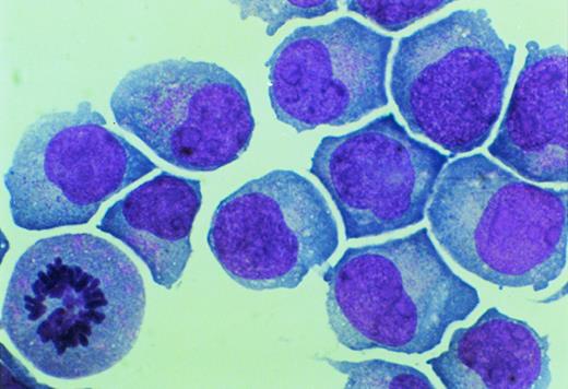 Fig. 1. Morphology of UG3 cultured in the presence of IL-3 (5 ng/mL). May-Grünwald-Giemsa staining. Original magnification, 300-fold.