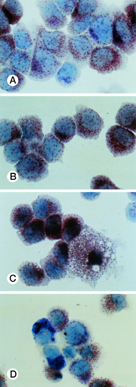 Fig. 5. Double staining for α-naphthyl butyrate esterase and naphthol AS-D chloracetate esterase of UG3 cells cultured with IL-3 (5 ng/mL; A), GM-CSF (1 ng/mL; B), M-CSF (100 ng/mL; C), and G-CSF (10 ng/mL; D) for 2 weeks. Original magnification, 200-fold. Histochemical analyses were performed using samples taken from four independent cell cultures.