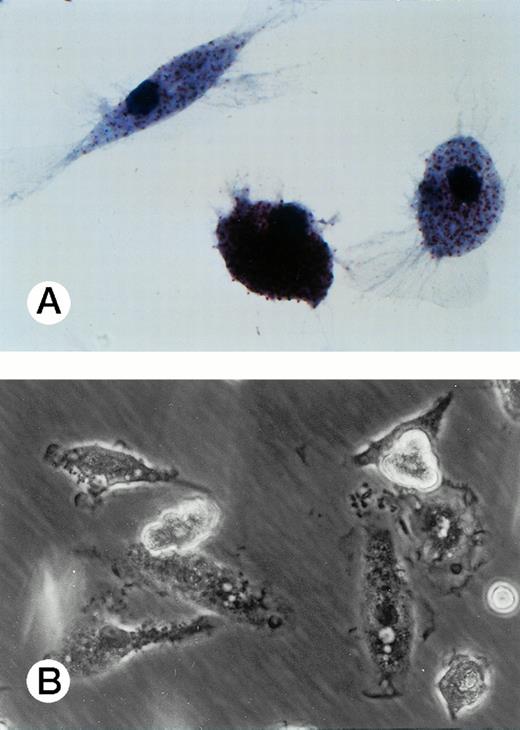Fig. 6. Adherent UG3 cells cultured in the presence of M-CSF (100 ng/mL) for 2 weeks. Double staining for a-naphthyl butyrate esterase and naphthol AS-D chloracetate esterase (A; original magnification, 100-fold) and phase-contrast microscopy (B; original magnification, 60-fold). Morphological analysis was performed of cells obtained from two independent cultures.