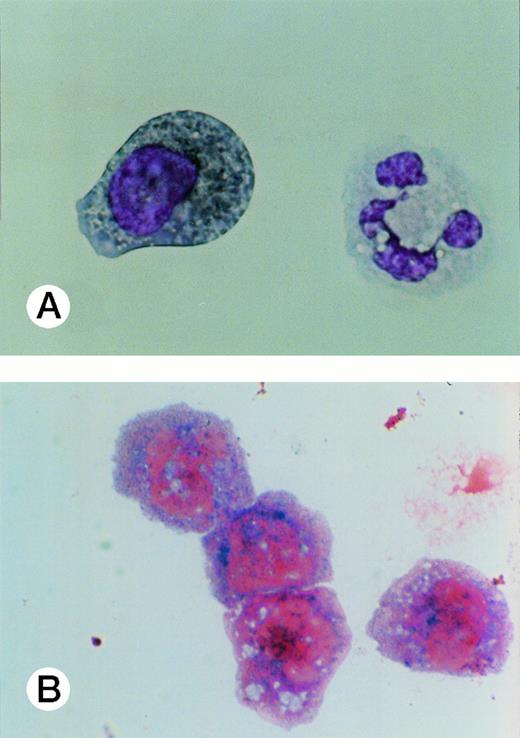 Fig. 7. Peroxidase (A) and neutrophilic alkaline phosphatase (B) staining of UG3 cells cultured in the presence of G-CSF (10 ng/mL) for 2 weeks. Original magnification, 300-fold. Histochemical analysis was performed with samples obtained from three independent cultures.