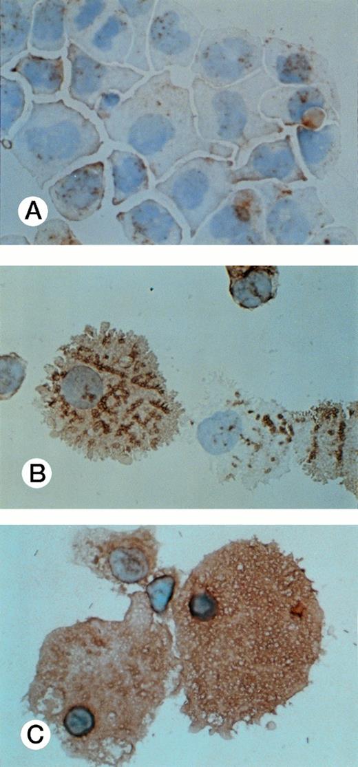 Fig. 8. CD68 expression was determined by immunohistochemistry of UG3 cells cultured with IL-3 (5 ng/mL; A), GM-CSF (1 ng/mL; B), or M-CSF (100 ng/mL; C) for 2 weeks. Original magnification, 200-fold. Histochemical analysis was performed with samples taken from three independent cultures.