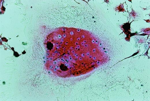 Fig. 10. Multinucleated giant cells formed after culture of UG3 cells for 2 weeks in the presence of M-CSF (100 ng/mL) and IL-4 (100 U/mL) stained for TRAP. Original magnification, 75-fold. Histochemical analysis was performed on cells obtained from three independent cultures.