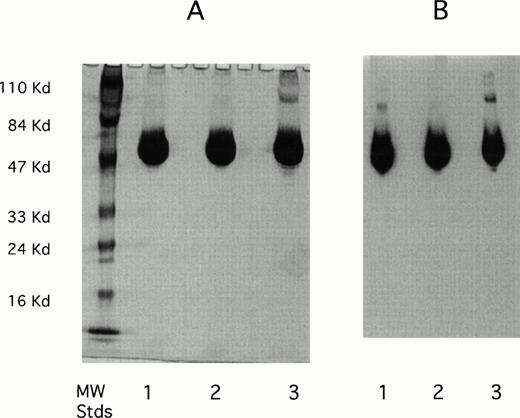 Fig. 2. SDS-PAGE gel (A) and Western blot (B) of rhAT (lane 1), rhAT assay standard (lane 2), and phAT (lane 3). Molecular weight markers are shown on the silver stained gel (A). Twenty micrograms of protein were applied to each sample lane (lanes 1, 2, and 3). The SDS-PAGE gel (A) was developed with the Morrissey silver stain, and the Western blot (B) was developed with a sheep antihuman AT-HRP antibody (SeroTec) and color development was the ECL system (Amersham).