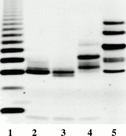 Fig. 11. FACE analysis of phAT (lane 2), goat plasma AT (lane 3), and rhAT (lane 4) N-glycanase released oligosaccharides. Lane 1 contains dextran polymers of varying length beginning with a trimer at the bottom of the gel and increasing by one sugar for each band to the top. Lane 5 contains a series of standard oligosaccharides (Dionex Corp) from bottom to top: disialylated biantennary, trisialylated triantennary, asialo biantennary, asialo triantennary, and asialotetraantennary complex oligosaccharides.