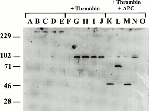 Fig. 5. APC cleavage of recombinant wild-type and mutant murine FV. Western blot analysis was performed using a rabbit anti-murine FV antibody which recognizes an epitope(s) on the N-terminal half of the FV heavy chain (residues 1-305). Lanes A through E are untreated conditioned media, lanes F through J are following activation with thrombin, and lanes K through O are following thrombin activation and subsequent treatment with APC. Lanes A, F, and O are conditioned media from mock-transfected cells; lanes B, G, and K, from cells transfected with wild-type FV; lanes C, H, and L, from cells transfected with R305Q mutant FV; lanes D, I, and M, from cells transfected with R504Q mutant FV; lanes E, J, and N, from cells transfected with R305Q/R504Q mutant FV.