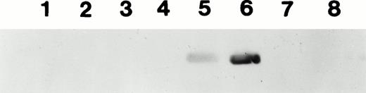 Fig. 3. Western blot to detect the formation of circulating antibody in the plasma of mice injected with 1 to 2 × 1011 particles of AAV-CMV-F.IX at day 1 of life. Lanes 1 through 8 show plasma samples from eight different animals taken at day 240 postinjection. Samples were diluted 1:500. Identical results were obtained from 1:200 dilutions (data not shown). Animals in lanes 5 and 6 had developed detectable levels of anti-hF.IX.