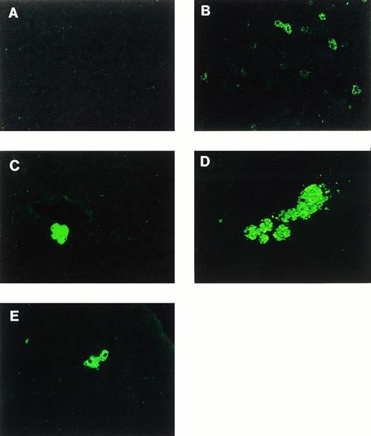Fig. 2. Immunofluorescence staining of human F.IX in mouse liver. (A) Uninjected animal. (B through E) Mice intravenously injected with 2 × 1011 particles of AAV-CMV-F.IX at day 1 of life. (B) Day 5 postinjection. (C and D) Day 240 postinjection. (E) Day 300 postinjection. Original magnification × 200 (×400 in E).