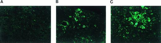 Fig. 6. Immunofluorescence staining of human F.IX expressed in hepatocytes 22 weeks after injection of AAV-CMV-F.IX (A) or AAV-EF1α-F.IX (B and C) into portal vein of adult C57BL/6 mice. The dose injected in the mouse used for liver sections (B) and (C) was 2.1 × 1010 vector genomes. Plasma levels of hF.IX were 120 ng/mL at the time this mouse was killed. Original magnification × 200.