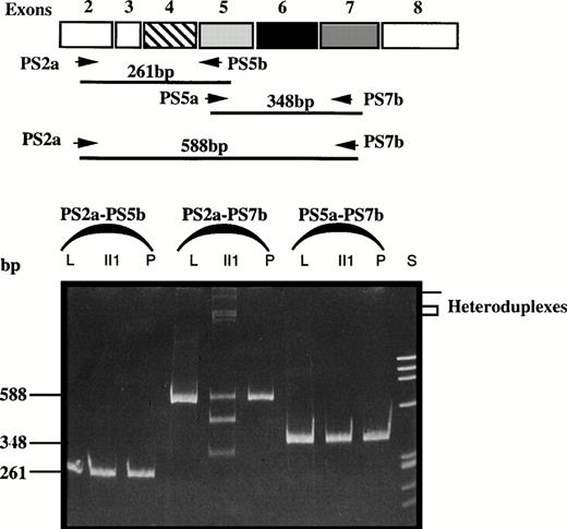 Fig. 2. Comparison of RT-PCR products of fragments PS2a-PS5b, PS2a-PS7b, and PS5a-PS7b of liver (L) and platelet (P) mRNA from two controls and platelet mRNA from patient II1. S, size standard; bp, basepair.