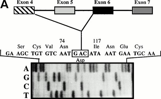 Fig. 3. (A) Direct sequencing of amplified fragment PS4a-PS6b2 showing the loss of exon 5. (B) Direct sequencing of amplified fragment PS4a-PS7b2 showing the loss of exons 5 and 6.