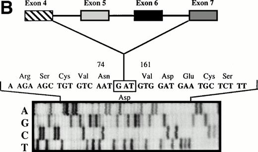 Fig. 3. (A) Direct sequencing of amplified fragment PS4a-PS6b2 showing the loss of exon 5. (B) Direct sequencing of amplified fragment PS4a-PS7b2 showing the loss of exons 5 and 6.