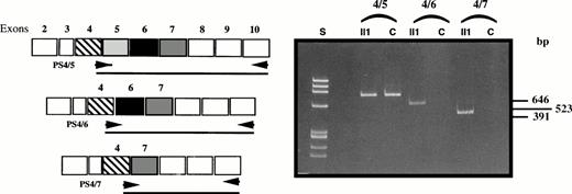 Fig. 4. Confirmation of the double exon skipping in patient II1 by analysis of fragments PS4/5-PS10b, PS4/6-PS10b, and PS4/7-PS10b compared with a control (C).