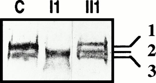 Fig. 5. Immunoblots of plasma PS from a normal control (C), patients II1 and I1 of family J, in reducing conditions.