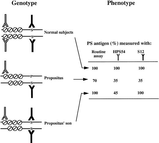 Fig. 6. Diagrammatic representation of binding of MoAbs binding to the two PS species present in the plasma of a normal subject, the propositus, and the propositus' son (deduced from the subject genotype). The figure shows PS domains significant for MoAb binding. The EGF domains are symbolized by a circle with a diagonal slash, and the amino acid at position 460 (P, Pro; S, Ser) is indicated by an uppercase letter. The MoAb recognizing EGF1 (HPS 54) is represented by a half-shaded symbol, and the MoAb containing Ser at position 460 (S12) of its epitope is in black. PS concentrations (percentage of the value for a normal pool) observed with the routine assay and two MoAb-based assays.§