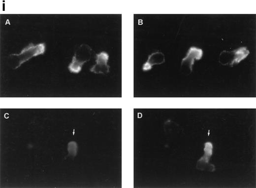 Fig. 3. CD43 clusters at the uropod of polarized TILs and colocalizes with moesin. (i) TILs were allowed to adhere to coverslips coated with FN80. Then, single (A and B) or double (C and D) immunostainings were performed as described under the Materials and Methods. (A and C) Staining with the anti-CD43 HP2/21 MoAb. (B and D) Staining with the antimoesin 38/87 MoAb. Arrows point to cellular uropods. (ii) TILs were cocultured on a monolayer of autologous melanoma cells for 1 hour at 37°C. Fixed cells were then stained with the anti-CD43 TP1/36 MoAb (A). In (B), the same field was photographed under bright field conditions. Note in (A) the typical migratory morphology of the TIL on melanoma cell (MC), showing the frontal leading edge (L) and the trailing uropod (U).