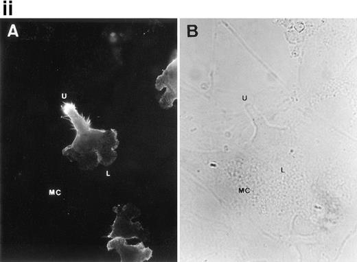 Fig. 3. CD43 clusters at the uropod of polarized TILs and colocalizes with moesin. (i) TILs were allowed to adhere to coverslips coated with FN80. Then, single (A and B) or double (C and D) immunostainings were performed as described under the Materials and Methods. (A and C) Staining with the anti-CD43 HP2/21 MoAb. (B and D) Staining with the antimoesin 38/87 MoAb. Arrows point to cellular uropods. (ii) TILs were cocultured on a monolayer of autologous melanoma cells for 1 hour at 37°C. Fixed cells were then stained with the anti-CD43 TP1/36 MoAb (A). In (B), the same field was photographed under bright field conditions. Note in (A) the typical migratory morphology of the TIL on melanoma cell (MC), showing the frontal leading edge (L) and the trailing uropod (U).
