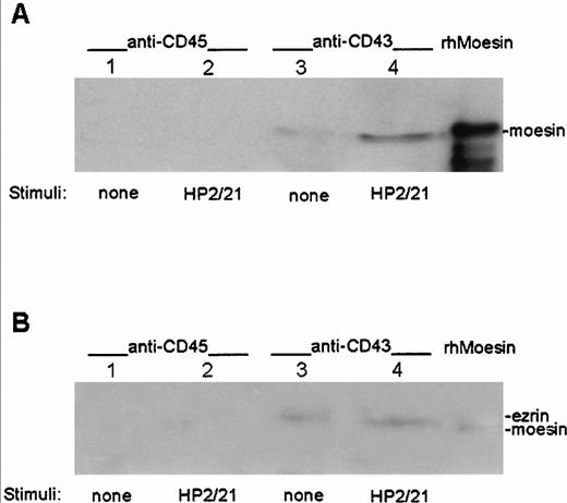 Fig. 4. Association of ezrin and moesin with CD43 in polarized T lymphoblasts. T cells either unstimulated (lanes 1 and 3) or stimulated with anti-CD43 HP2/21 MoAb (lanes 2 and 4) were allowed to adhere to FN80. Cells were then lysed and the soluble fraction was immunoprecipitated with the anti-CD45 RP2/21 (lanes 1 and 2) and anti-CD43 TP1/36 MoAb (lanes 3 and 4). A human recombinant moesin standard was run in the right lanes. Each immunoprecipitate as well as standards were immunoblotted with the antimoesin 95/2 pAb after SDS 7.5% PAGE (A) and reprobed with the anti-ezrin 90/3 pAb (B) as described under the Materials and Methods.