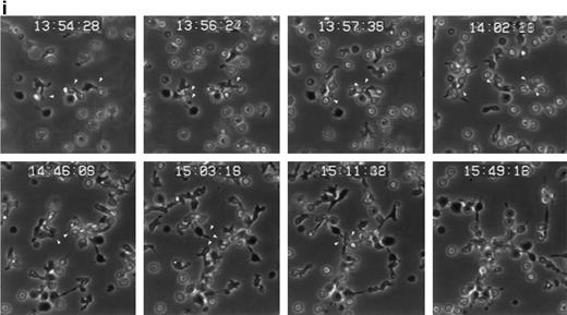 Fig. 6. Dynamics of CD43 and moesin during cell aggregation. (i) T lymphoblasts adhered to FN80 were treated with the proaggregatory anti-CD43 HP2/21 MoAb. Time-lapse videomicroscopy analysis was then performed as described in the Materials and Methods. Sequential time frames are shown. White arrowheads point to uropods of cells participating in the formation of small and large aggregates. (ii) T lymphoblast aggregation was induced by using the anti-CD43 HP2/21 MoAb, and upon cell incubation at 37°C for 5 (A), 10 (B), and 30 (C) minutes, cells were fixed and stained for CD43. (iii) Similarly, 5 (A) and 30 (B) minutes after the triggering of cell aggregation with the anti-CD43 HP2/21 MoAb, cells were fixed and stained for moesin by using the biotinylated antimoesin 38/87 MoAb. The same cells were photographed under epifluorescent (above) and bright field (below) conditions. Arrows point to cellular uropods.
