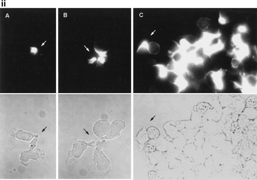 Fig. 6. Dynamics of CD43 and moesin during cell aggregation. (i) T lymphoblasts adhered to FN80 were treated with the proaggregatory anti-CD43 HP2/21 MoAb. Time-lapse videomicroscopy analysis was then performed as described in the Materials and Methods. Sequential time frames are shown. White arrowheads point to uropods of cells participating in the formation of small and large aggregates. (ii) T lymphoblast aggregation was induced by using the anti-CD43 HP2/21 MoAb, and upon cell incubation at 37°C for 5 (A), 10 (B), and 30 (C) minutes, cells were fixed and stained for CD43. (iii) Similarly, 5 (A) and 30 (B) minutes after the triggering of cell aggregation with the anti-CD43 HP2/21 MoAb, cells were fixed and stained for moesin by using the biotinylated antimoesin 38/87 MoAb. The same cells were photographed under epifluorescent (above) and bright field (below) conditions. Arrows point to cellular uropods.