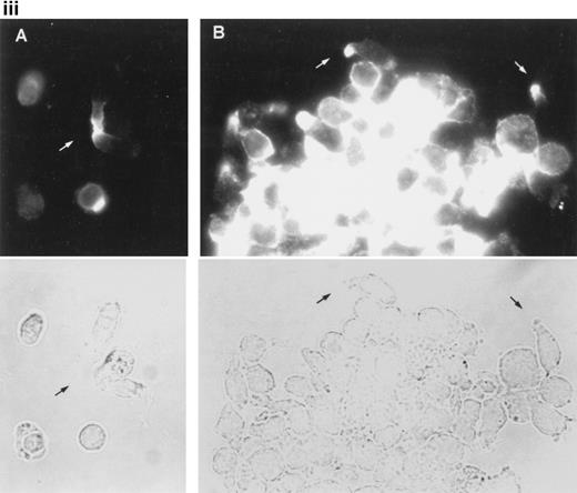 Fig. 6. Dynamics of CD43 and moesin during cell aggregation. (i) T lymphoblasts adhered to FN80 were treated with the proaggregatory anti-CD43 HP2/21 MoAb. Time-lapse videomicroscopy analysis was then performed as described in the Materials and Methods. Sequential time frames are shown. White arrowheads point to uropods of cells participating in the formation of small and large aggregates. (ii) T lymphoblast aggregation was induced by using the anti-CD43 HP2/21 MoAb, and upon cell incubation at 37°C for 5 (A), 10 (B), and 30 (C) minutes, cells were fixed and stained for CD43. (iii) Similarly, 5 (A) and 30 (B) minutes after the triggering of cell aggregation with the anti-CD43 HP2/21 MoAb, cells were fixed and stained for moesin by using the biotinylated antimoesin 38/87 MoAb. The same cells were photographed under epifluorescent (above) and bright field (below) conditions. Arrows point to cellular uropods.