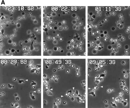Fig. 7. Myosin-disruption prevents CD43-mediated cell aggregation. (A) T lymphoblasts were pretreated during 30 minutes with 20 mmol/L of butanedione monoxime. Cells were then allowed to adhere to FN80 in the presence of the proaggregatory anti-CD43 HP2/21 MoAb. Cells were filmed with a time-lapse videocassete recorder for 10 hours. Note the lack of cell polarization and aggregation in the first 2 hours recorded. White arrowheads point to cellular uropods displayed by cells after 9 hours of anti-CD43 treatment. (B) T lymphoblasts were incubated for 30 minutes at 37°C in the presence of 10 mmol/L butanedione monoxime (▪), 20 μmol/L colchicine (▴), or 20 μmol/L cytochalasin D (⧫) or in the absence of any cytoskeletal drug (•), before the addition of anti-CD43 HP2/21 MoAb. The percentage of aggregation was calculated at different times as described in the Materials and Methods.