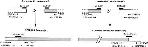 Fig. 1. Schematic diagram of NPM and ALK regions rearranged by t(2;5) (according to Ladanyi and Cavalchire55) and mRNA. NPM and ALK exons, whose normal sizes are unknown, are shown as open boxes, and single lines represent introns. The relative approximate positions of PCR primers and probes used in our study are indicated.
