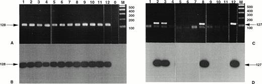 Fig. 2. Detection of NPM-ALK and reciprocal ALK-NPM transcripts by nested RT-PCR. Total RNA was extracted from frozen skin biopsies or cultured cells and submitted to nested RT-PCR analysis, followed by electrophoresis on 2% agarose gel. Lanes 1, 2 and 3, cases no. 1, 2, and 3, respectively, CD30+ secondary CLCL; lane 4, case no. 4, LyP; lanes 5 through 11, cases no. 5 through 11, CD30+ primary CLCL; lane 12, t(2;5)+SU-DHL-1 cell line; lane 0, no template; lane M, molecular weight marker 100-bp DNA ladder (GIBCO-BRL). Detection of NPM-ALK transcripts: (A) ethidium bromide staining and (B) radioautography. Detection of ALK-NPM transcripts: (C) ethidium bromide staining and (D) radioautography. The gels were transferred to a nylon membrane, hybridized either with the NPM-ALK-J probe (B) or the ALK-NPM-J probe (D), and radioautographed. Sizes are indicated in bases.